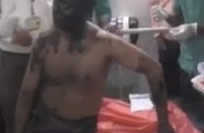 ABVP attacks professor, blackens face, parades him