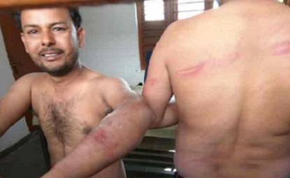 Journalism  Torture  Police  Crime  Madhya Pradesh  Custodial torture  Bhopal  Shivraj Singh Chouhan