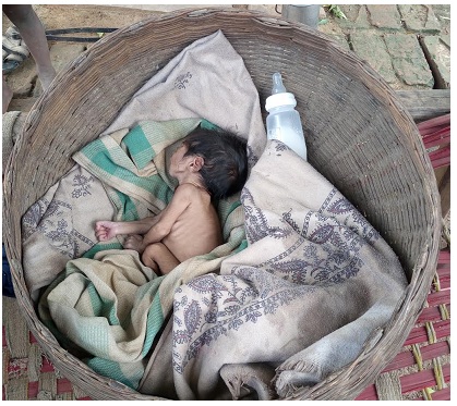 malnutrition deaths  Madhya Pradesh  CRY  slam  IMR  highest  second  NHRC  MPHRC